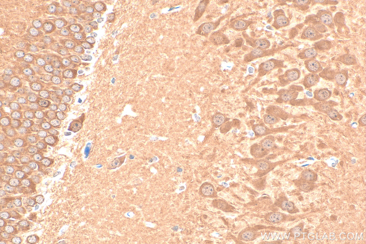 Immunohistochemistry (IHC) staining of rat brain tissue using PPM1E Polyclonal antibody (25089-1-AP)