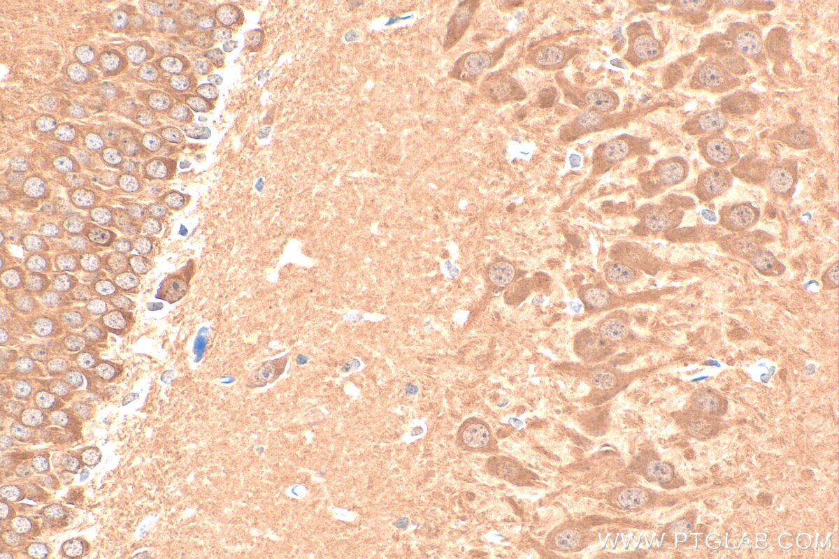 IHC staining of rat brain using 25089-1-AP