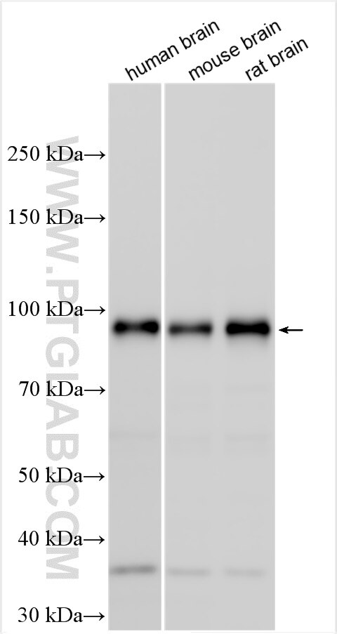 Western Blot (WB) analysis of various lysates using PPM1E Polyclonal antibody (25089-1-AP)