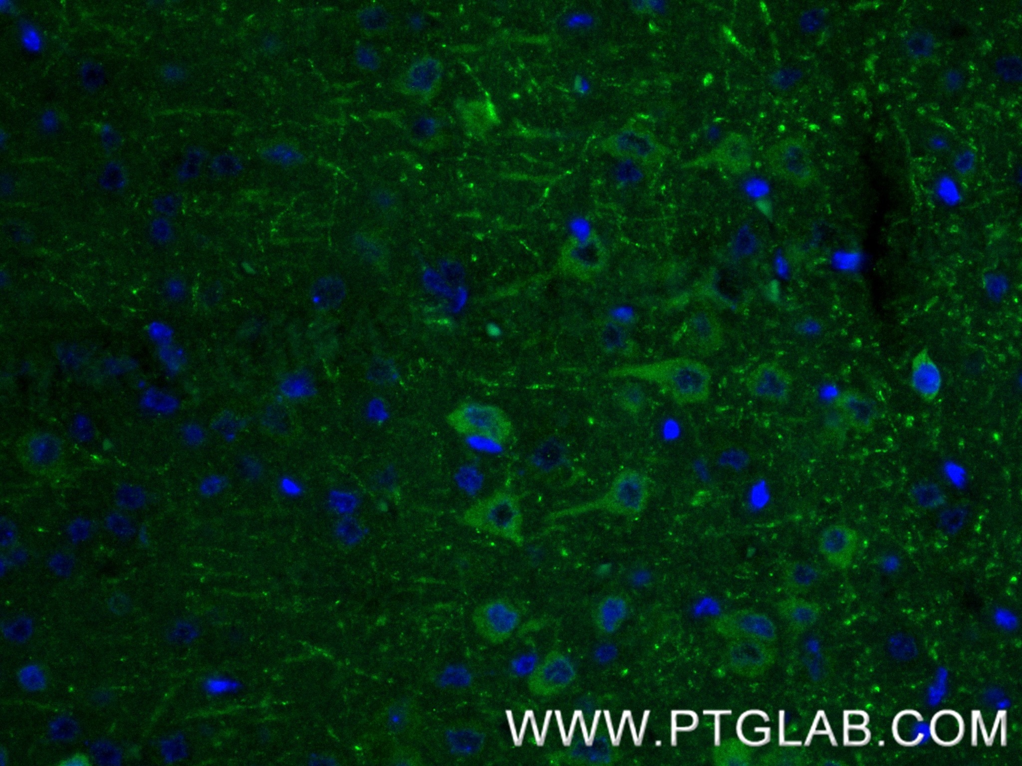 IF Staining of mouse brain using 87405-1-RR Immunofluorescence (IF) / fluorescent staining of mouse brain tissue using PPM1E Recombinant monoclonal antibody (87405-1-RR)