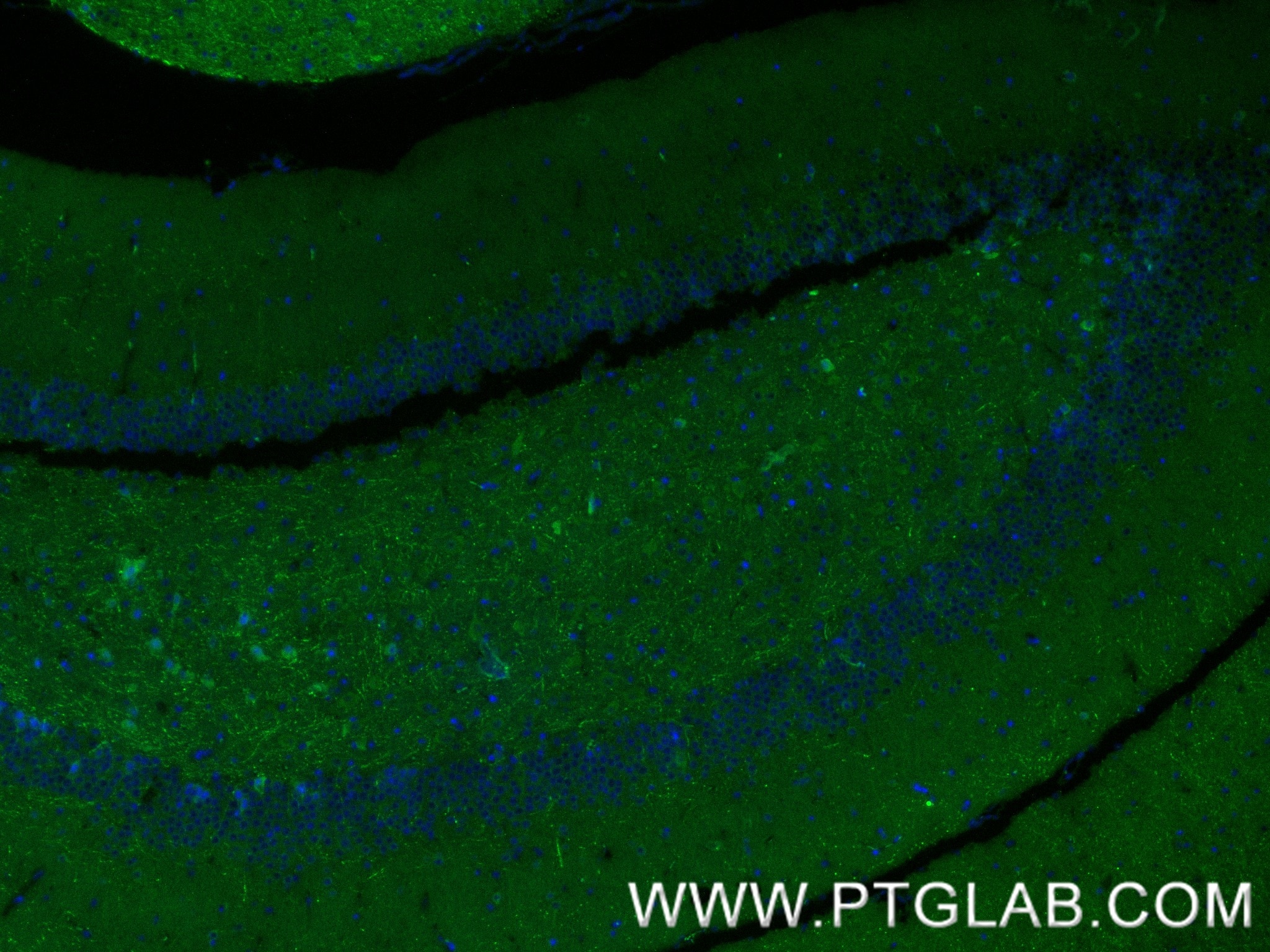 IF Staining of mouse brain using 87405-1-RR Immunofluorescence (IF) / fluorescent staining of mouse brain tissue using PPM1E Recombinant monoclonal antibody (87405-1-RR)
