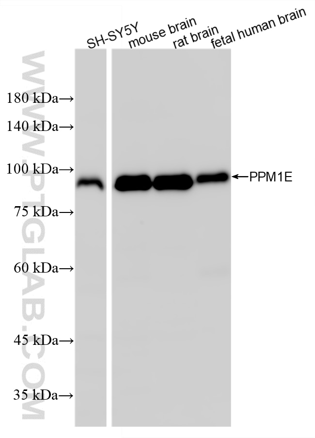 WB analysis using 87405-1-RR Western Blot (WB) analysis of various lysates using PPM1E Recombinant monoclonal antibody (87405-1-RR)