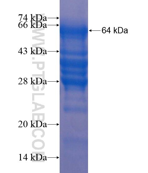 PPM1E fusion protein Ag18751 SDS-PAGE