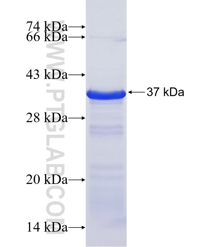 PPM1E fusion protein Ag18903 SDS-PAGE PPM1E fusion protein Ag18903 SDS-PAGE