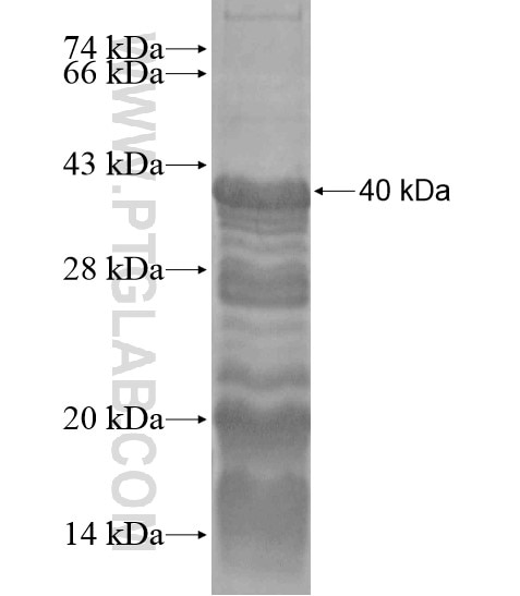 PPM1E fusion protein Ag18903 SDS-PAGE