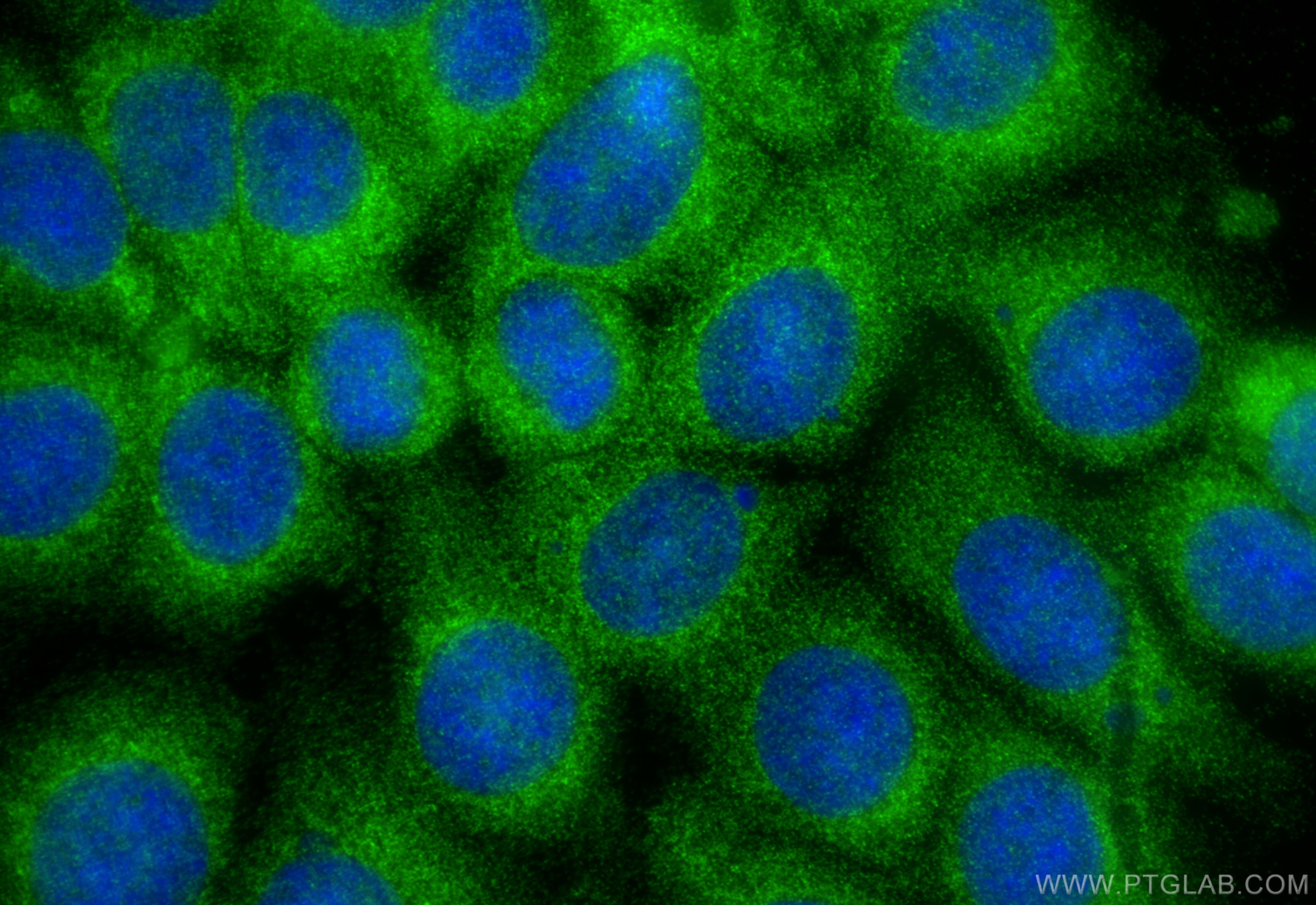 Immunofluorescence (IF) / fluorescent staining of MCF-7 cells using PPM1F Polyclonal antibody (17020-1-AP)
