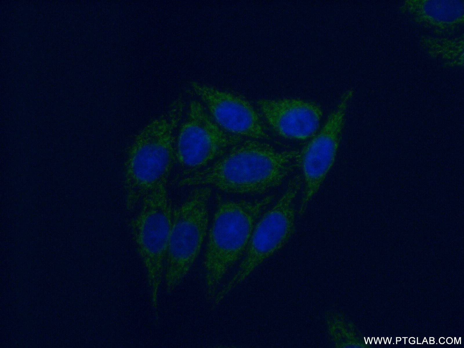 Immunofluorescence (IF) / fluorescent staining of HepG2 cells using PPM1F Polyclonal antibody (17020-1-AP)
