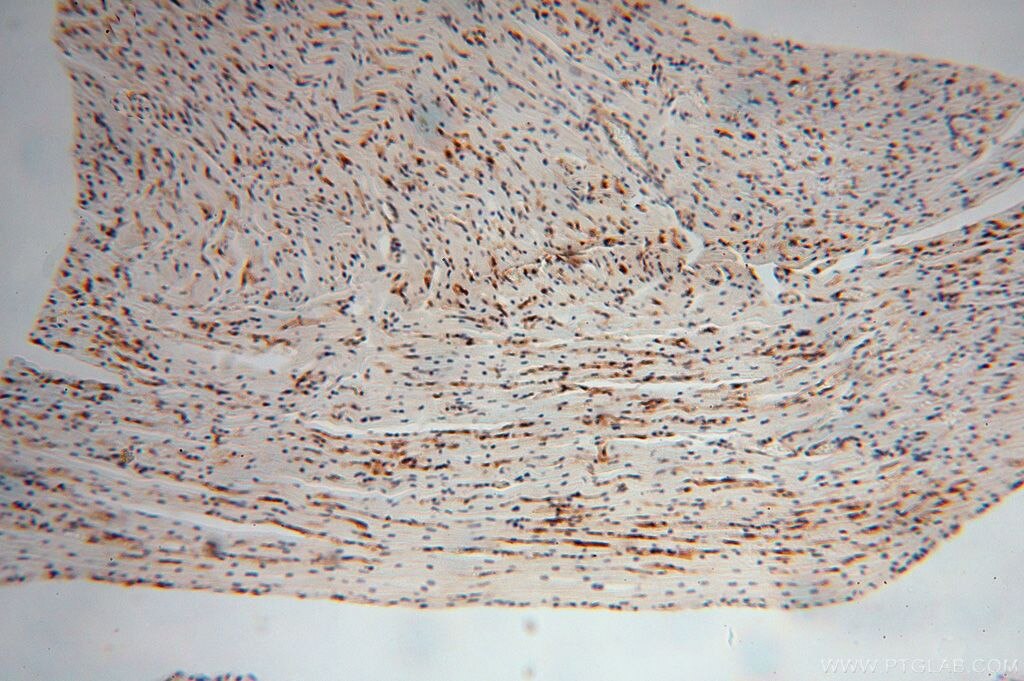 PPM1F