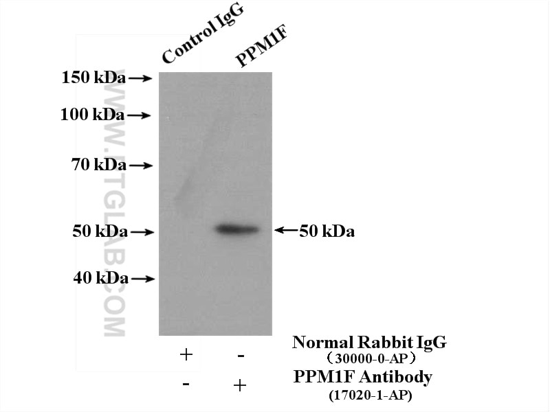 Immunoprecipitation (IP) experiment of MCF-7 cells using PPM1F Polyclonal antibody (17020-1-AP)