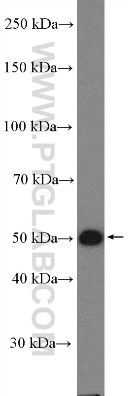 Western Blot (WB) analysis of HeLa cells using PPM1F Polyclonal antibody (17020-1-AP)