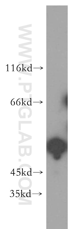 Western Blot (WB) analysis of HepG2 cells using PPM1F Polyclonal antibody (17020-1-AP)