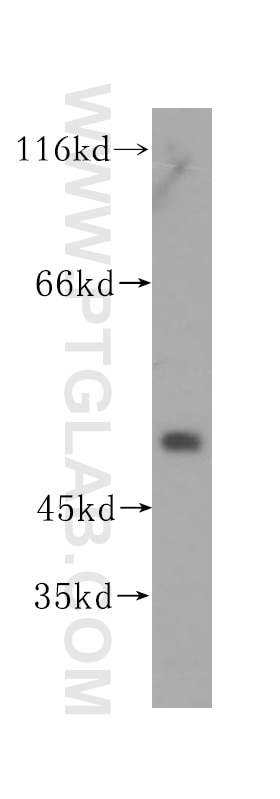 Western Blot (WB) analysis of human liver tissue using PPM1F Polyclonal antibody (17020-1-AP)