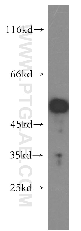 Western Blot (WB) analysis of K-562 cells using PPM1F Polyclonal antibody (17020-1-AP)
