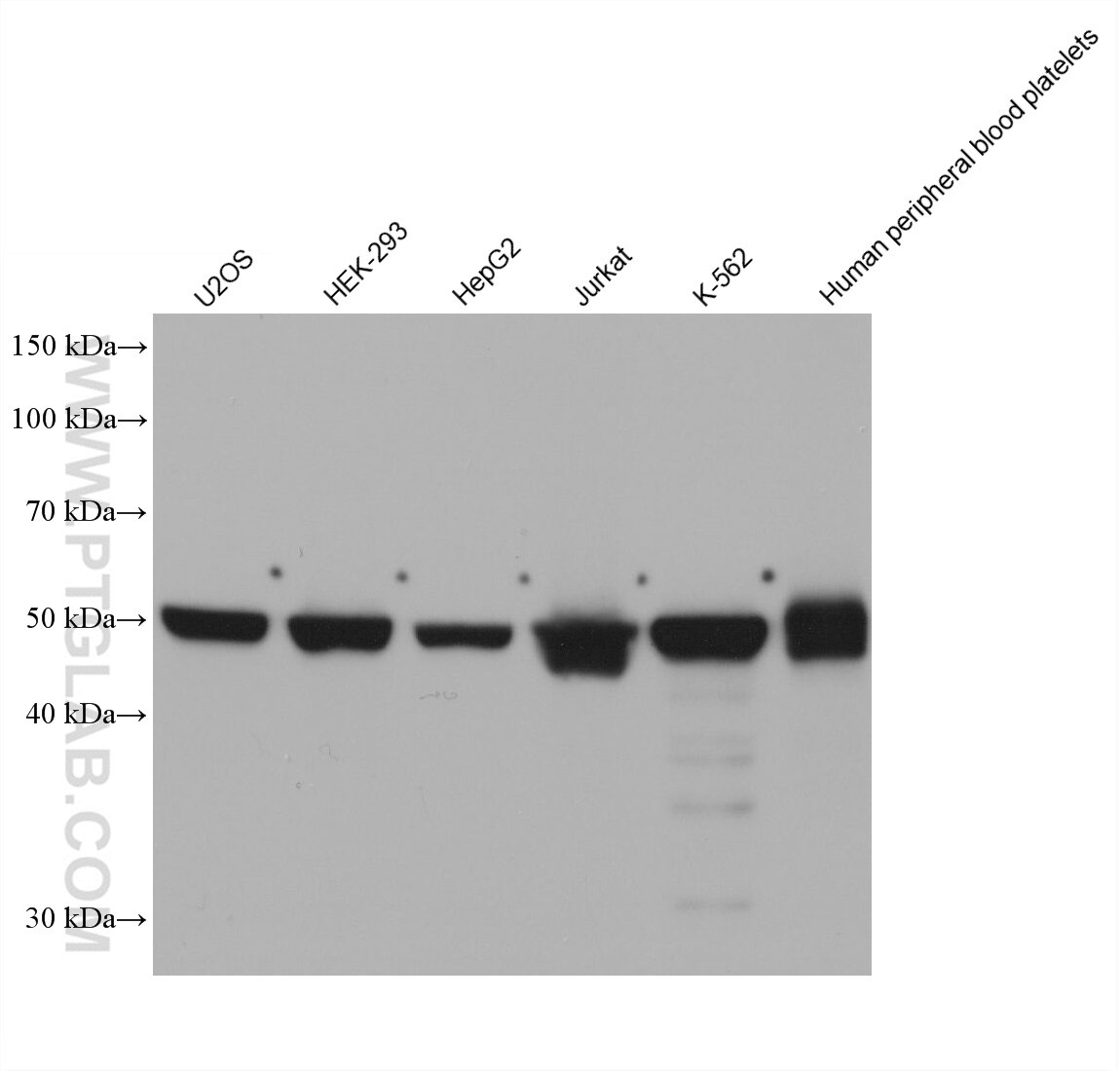 Western Blot (WB) analysis of various lysates using PPM1F Monoclonal antibody (68626-1-Ig)