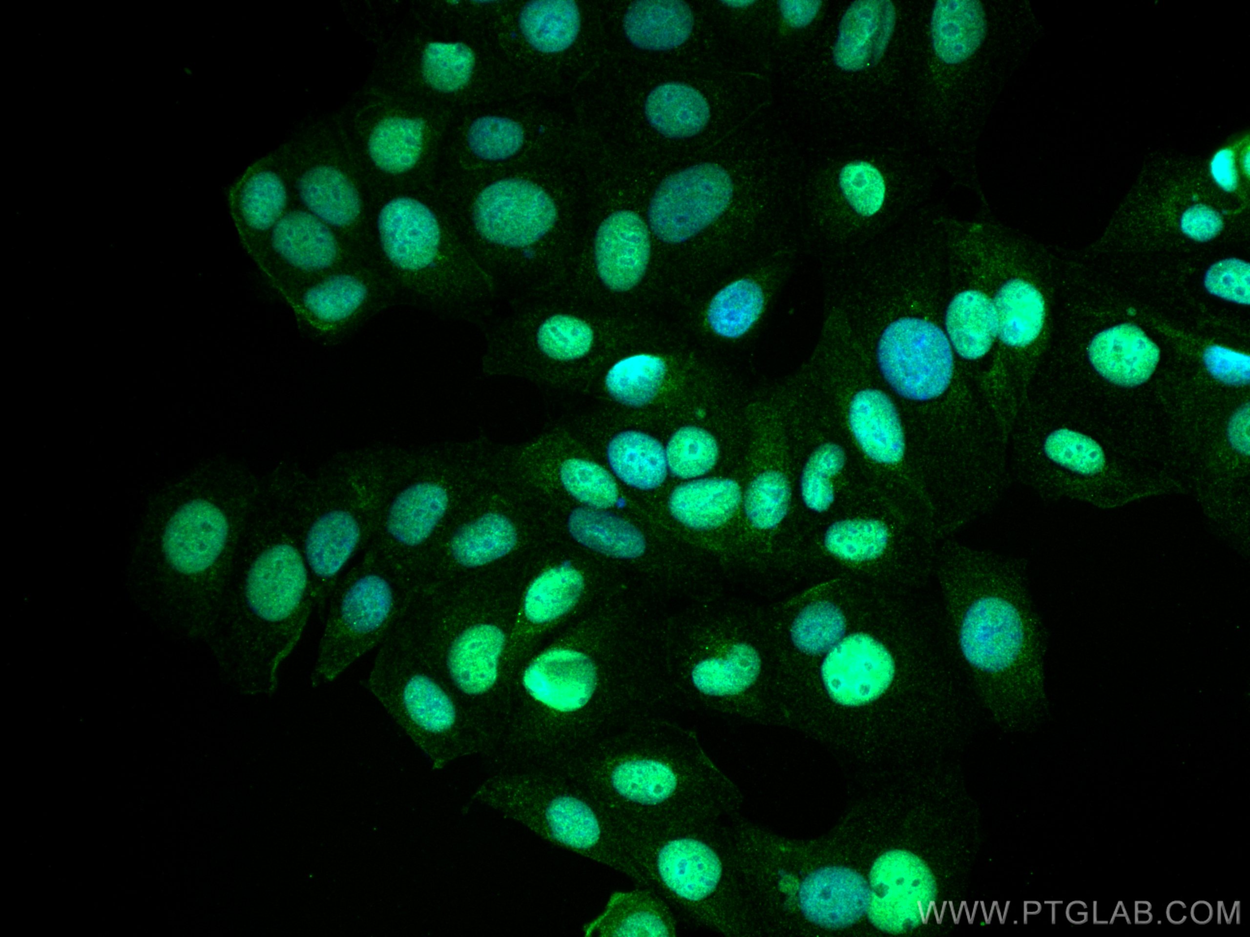 Immunofluorescence (IF) / fluorescent staining of MCF-7 cells using PPM1G Polyclonal antibody (15532-1-AP)