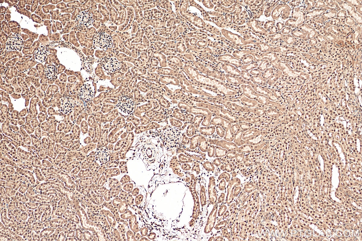 Immunohistochemistry (IHC) staining of mouse kidney tissue using PPM1G Polyclonal antibody (15532-1-AP)