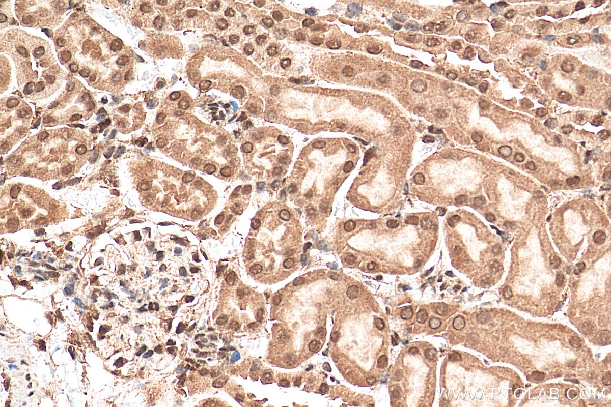 Immunohistochemistry (IHC) staining of mouse kidney tissue using PPM1G Polyclonal antibody (15532-1-AP)