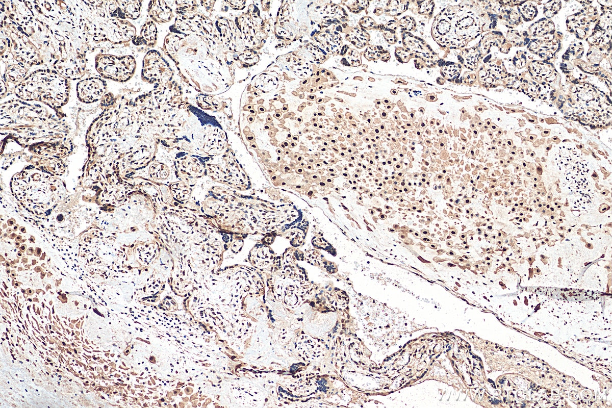 Immunohistochemistry (IHC) staining of human placenta tissue using PPM1G Polyclonal antibody (15532-1-AP)