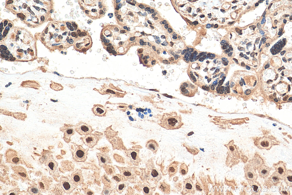 Immunohistochemistry (IHC) staining of human placenta tissue using PPM1G Polyclonal antibody (15532-1-AP)