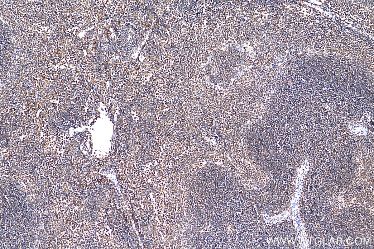 Immunohistochemistry (IHC) staining of mouse spleen tissue using PPM1G Polyclonal antibody (15532-1-AP)