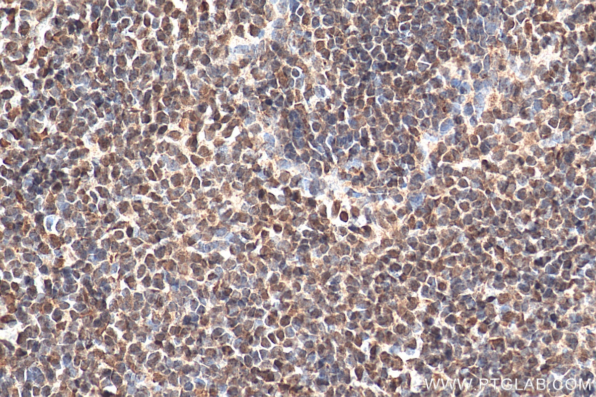 Immunohistochemistry (IHC) staining of mouse spleen tissue using PPM1G Polyclonal antibody (15532-1-AP)
