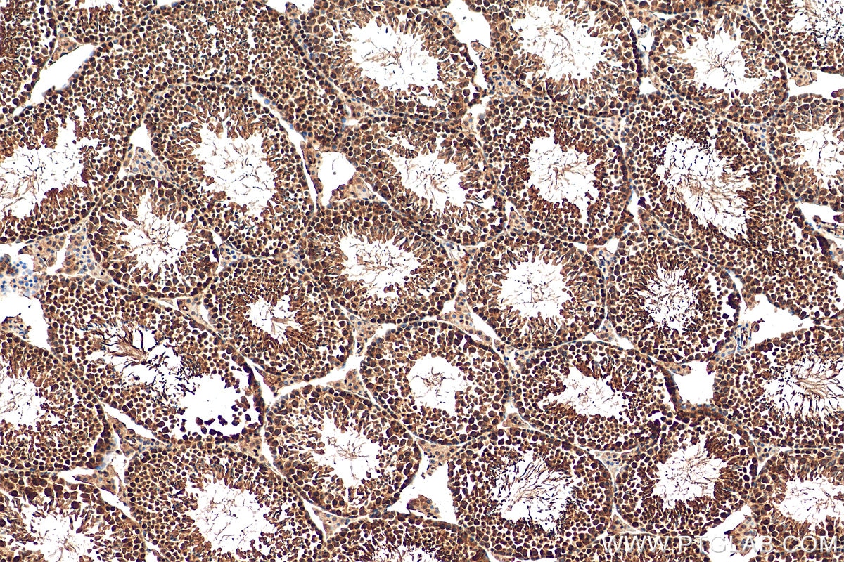 Immunohistochemistry (IHC) staining of mouse testis tissue using PPM1G Polyclonal antibody (15532-1-AP)
