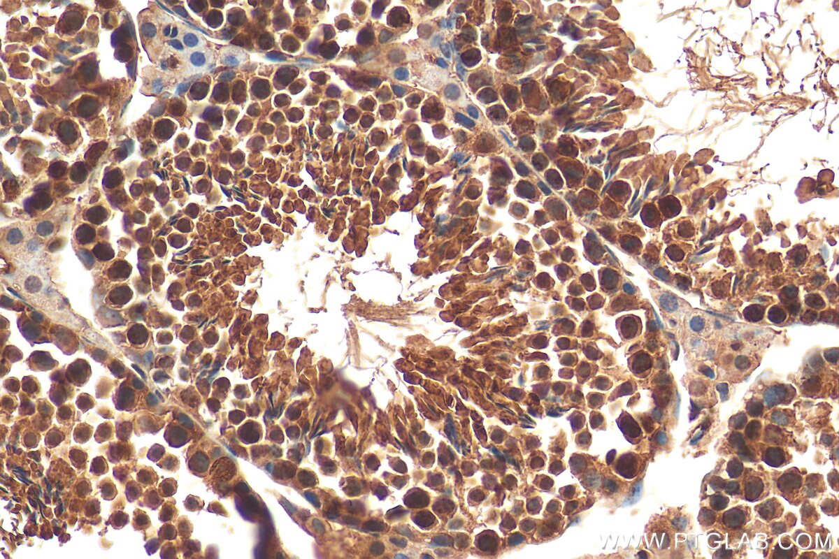 Immunohistochemistry (IHC) staining of mouse testis tissue using PPM1G Polyclonal antibody (15532-1-AP)