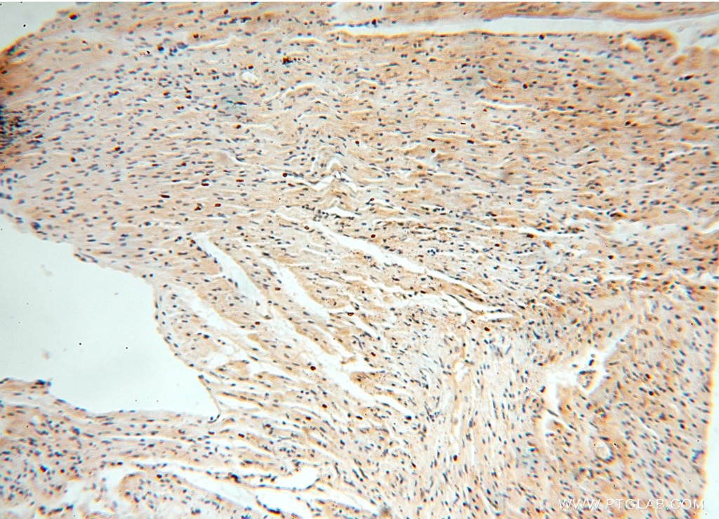 Immunohistochemistry (IHC) staining of human heart tissue using PPM1G Polyclonal antibody (15532-1-AP)