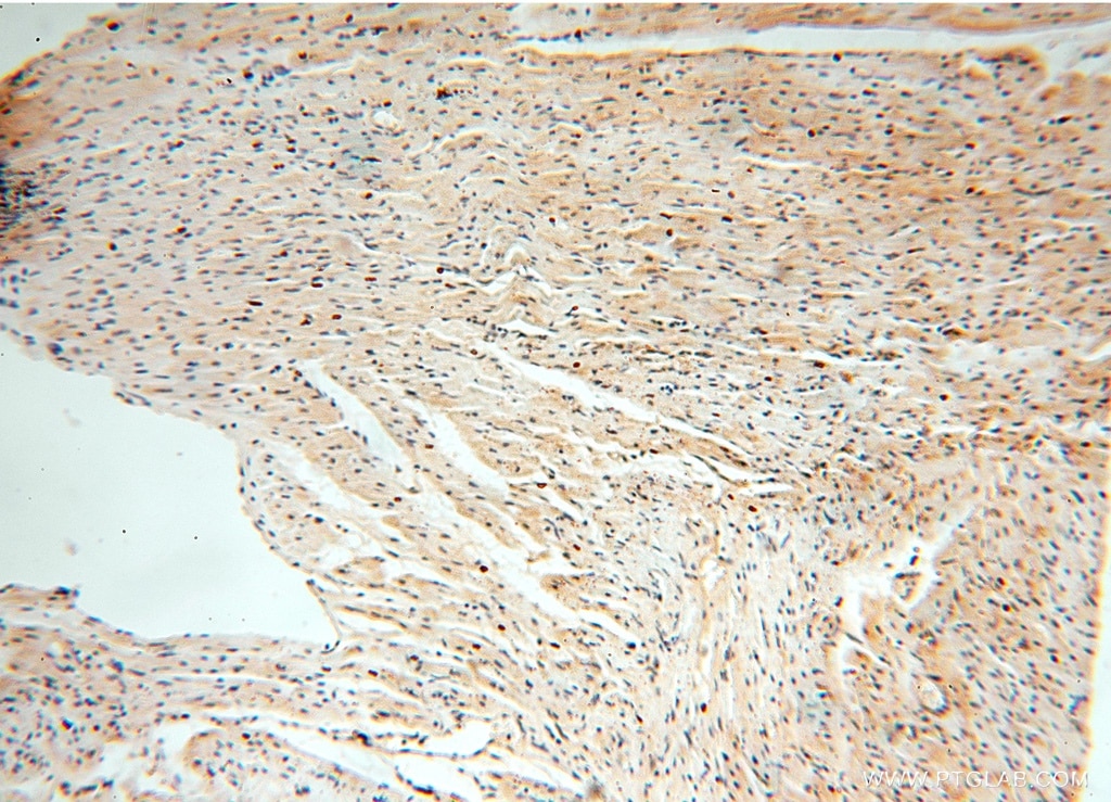 Immunohistochemistry (IHC) staining of human heart tissue using PPM1G Polyclonal antibody (15532-1-AP)