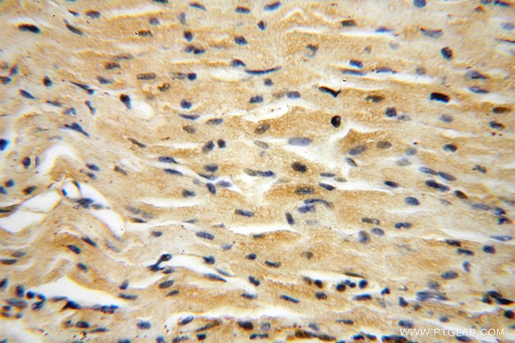IHC staining of human heart using 15532-1-AP
