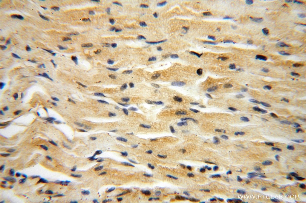 Immunohistochemistry (IHC) staining of human heart tissue using PPM1G Polyclonal antibody (15532-1-AP)