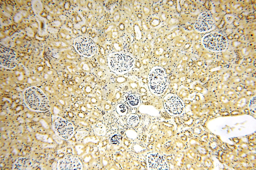 Immunohistochemistry (IHC) staining of human kidney tissue using PPM1G Polyclonal antibody (15532-1-AP)