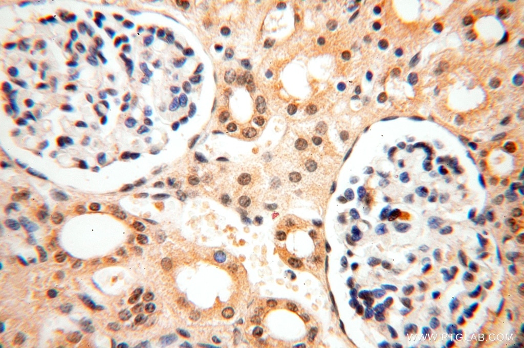 Immunohistochemistry (IHC) staining of human kidney tissue using PPM1G Polyclonal antibody (15532-1-AP)