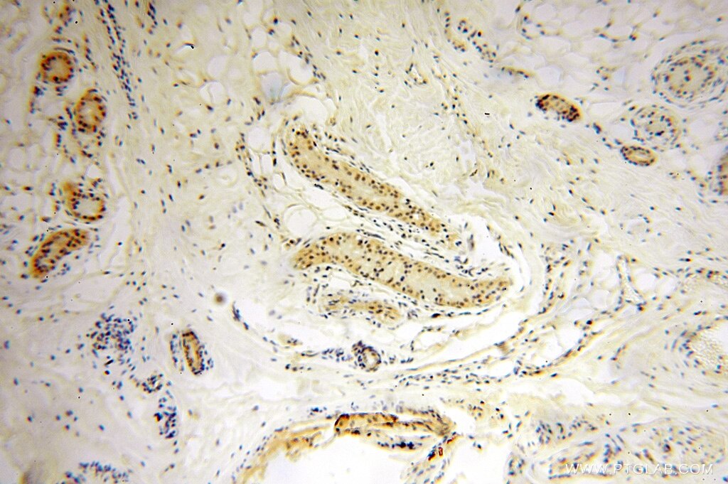 IHC staining of human skin using 15532-1-AP