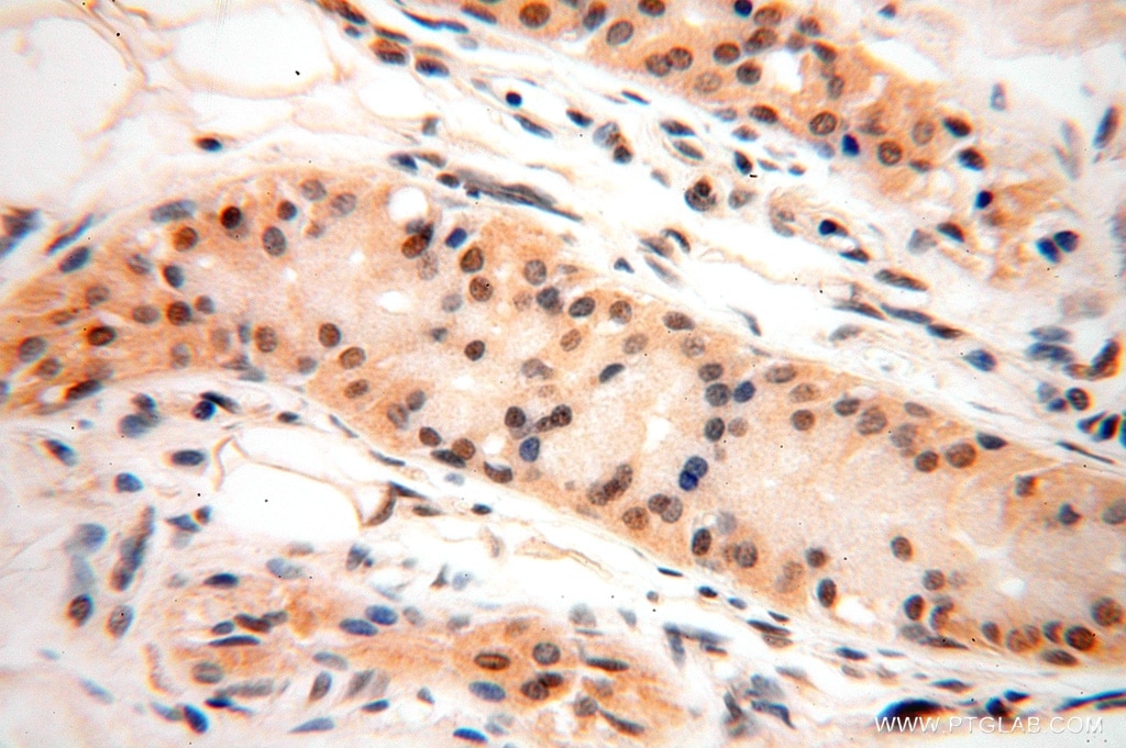 Immunohistochemistry (IHC) staining of human skin tissue using PPM1G Polyclonal antibody (15532-1-AP)
