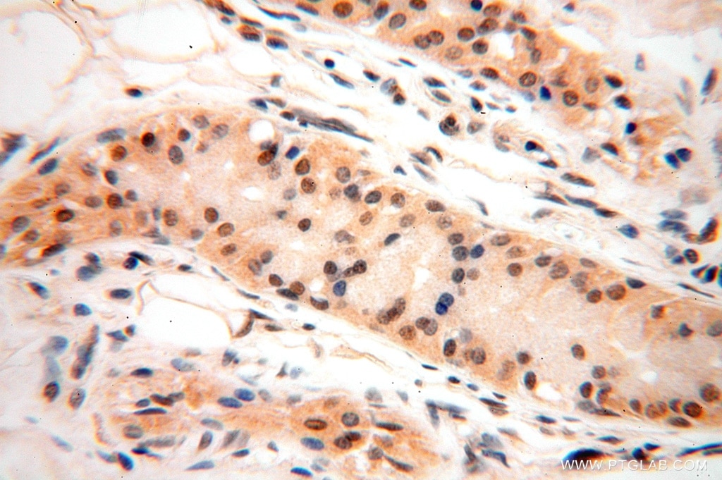 IHC staining of human skin using 15532-1-AP