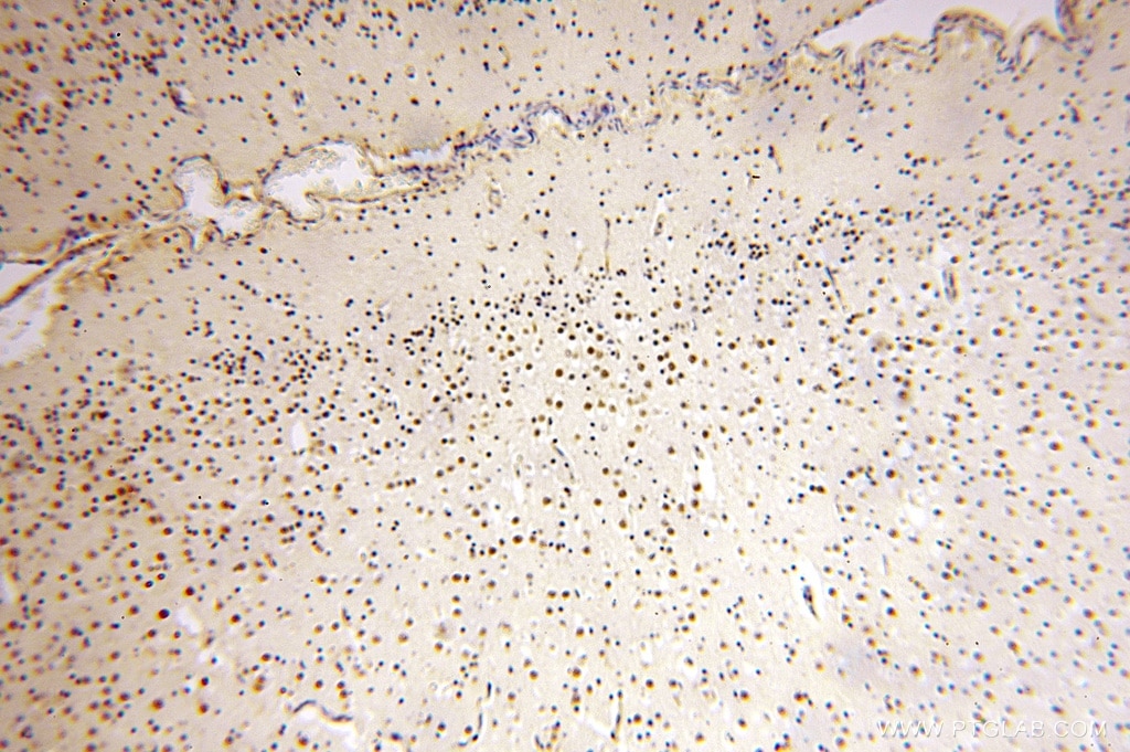 Immunohistochemistry (IHC) staining of human brain tissue using PPM1G Polyclonal antibody (15532-1-AP)