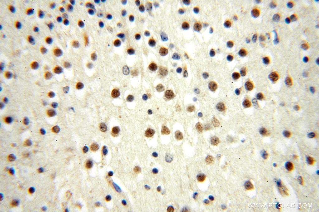 Immunohistochemistry (IHC) staining of human brain tissue using PPM1G Polyclonal antibody (15532-1-AP)