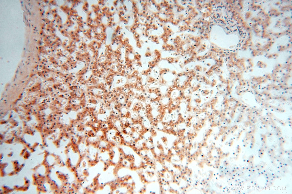Immunohistochemistry (IHC) staining of human liver tissue using PPM1G Polyclonal antibody (15532-1-AP)