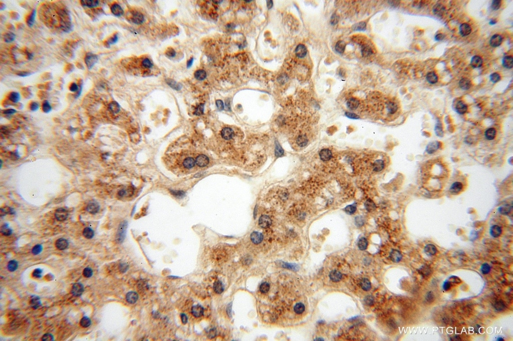 Immunohistochemistry (IHC) staining of human liver tissue using PPM1G Polyclonal antibody (15532-1-AP)