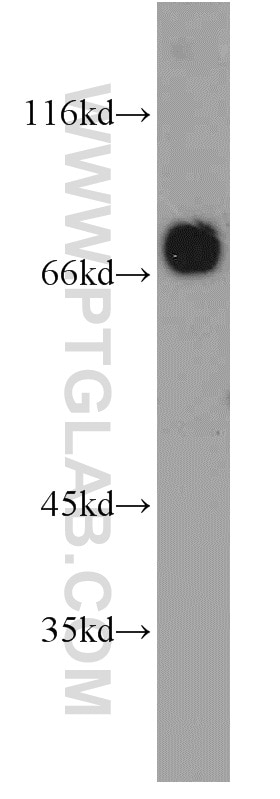 Western Blot (WB) analysis of mouse lung tissue using PPM1G Polyclonal antibody (15532-1-AP)