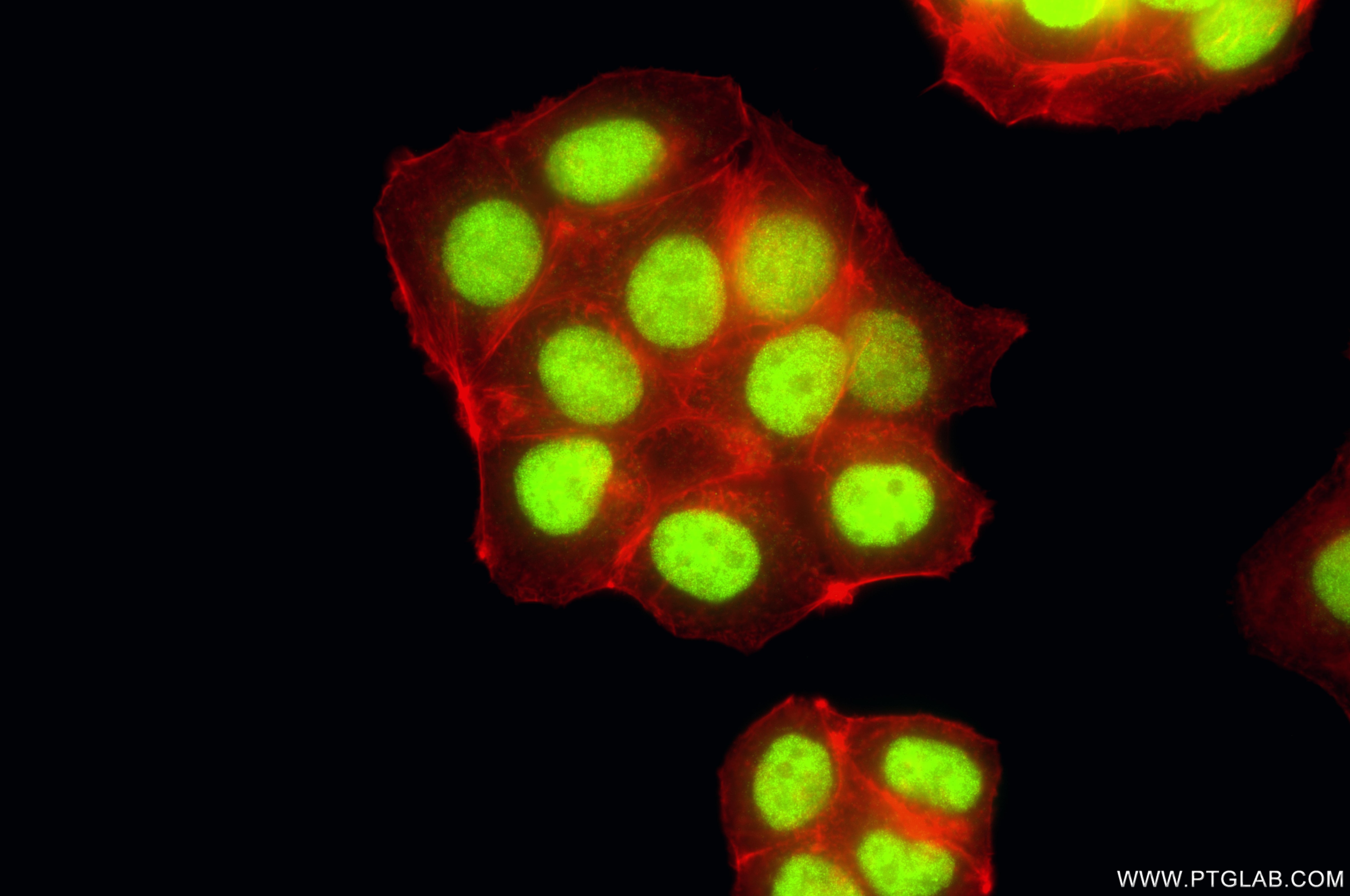 Immunofluorescence (IF) / fluorescent staining of MCF-7 cells using PPM1G Recombinant monoclonal antibody (87250-3-RR)