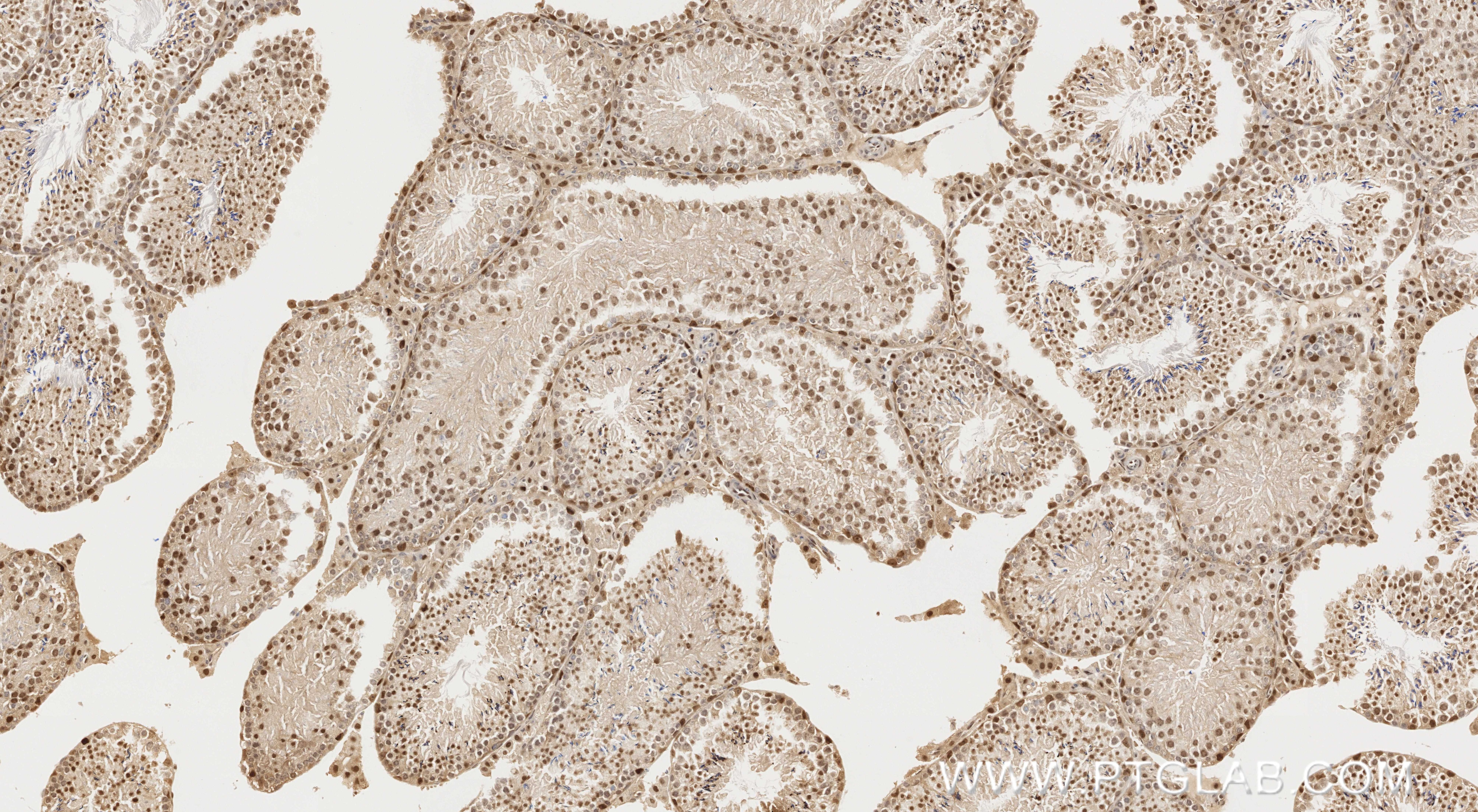 Immunohistochemistry (IHC) staining of mouse testis tissue using PPM1G Recombinant monoclonal antibody (87250-3-RR)