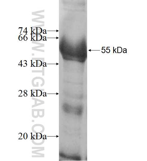 PPM1G fusion protein Ag7751 SDS-PAGE