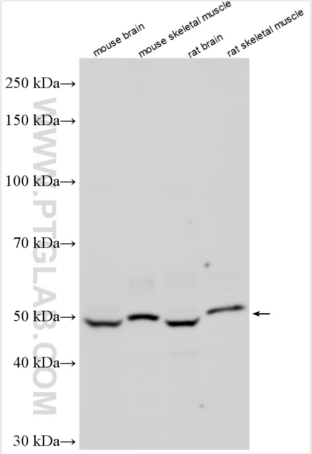 Western Blot (WB) analysis of various lysates using PPM1J Polyclonal antibody (16269-1-AP)