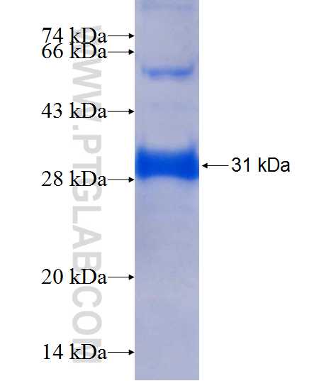 PPM1J fusion protein Ag9226 SDS-PAGE