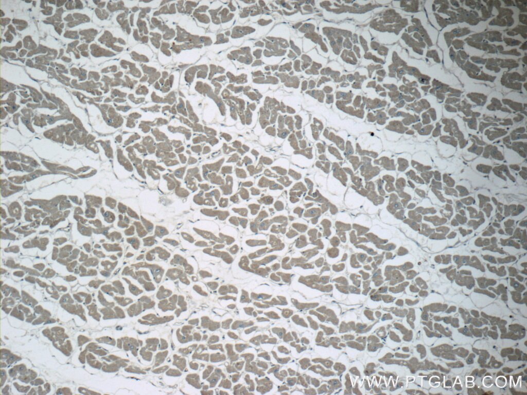 Immunohistochemistry (IHC) staining of human heart tissue using PPM1L Polyclonal antibody (18203-1-AP)