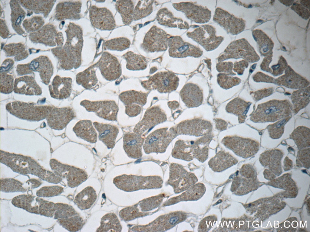 Immunohistochemistry (IHC) staining of human heart tissue using PPM1L Polyclonal antibody (18203-1-AP)