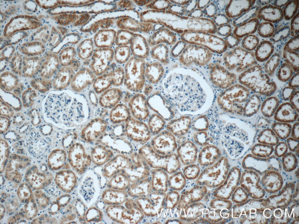Immunohistochemistry (IHC) staining of human kidney tissue using PPM1L Polyclonal antibody (18203-1-AP)