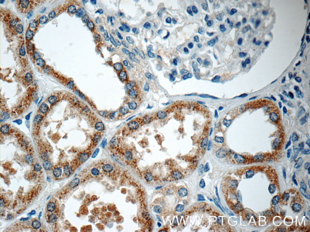 Immunohistochemistry (IHC) staining of human kidney tissue using PPM1L Polyclonal antibody (18203-1-AP)